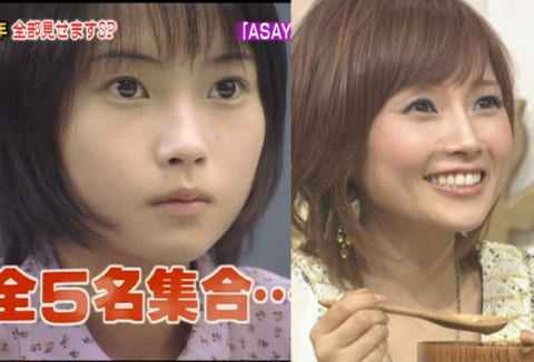 埋没法で二重にした芸能人28名～整形に成功・失敗？【最新版】